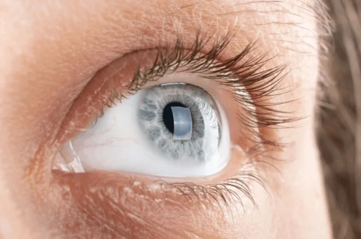 Cornea