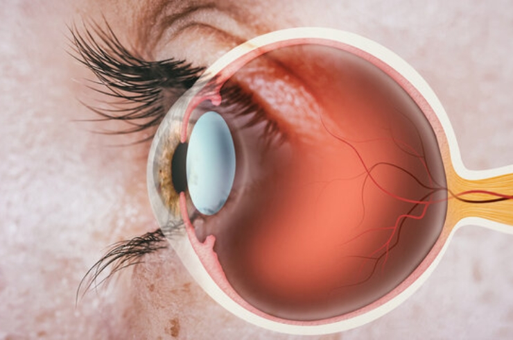 Retina